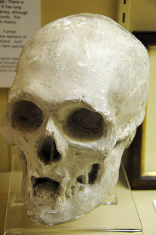 Cast of Robert's Skull, Dumfries Museum